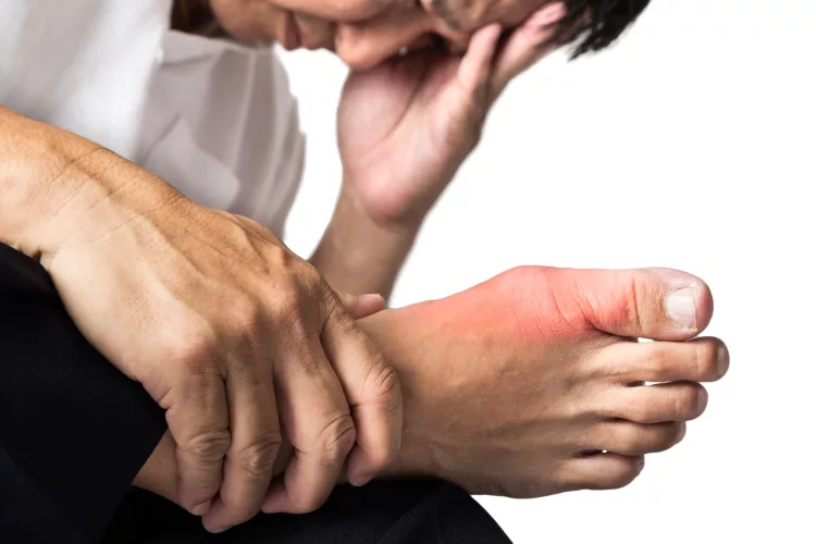 Man with gout inflammation Image
