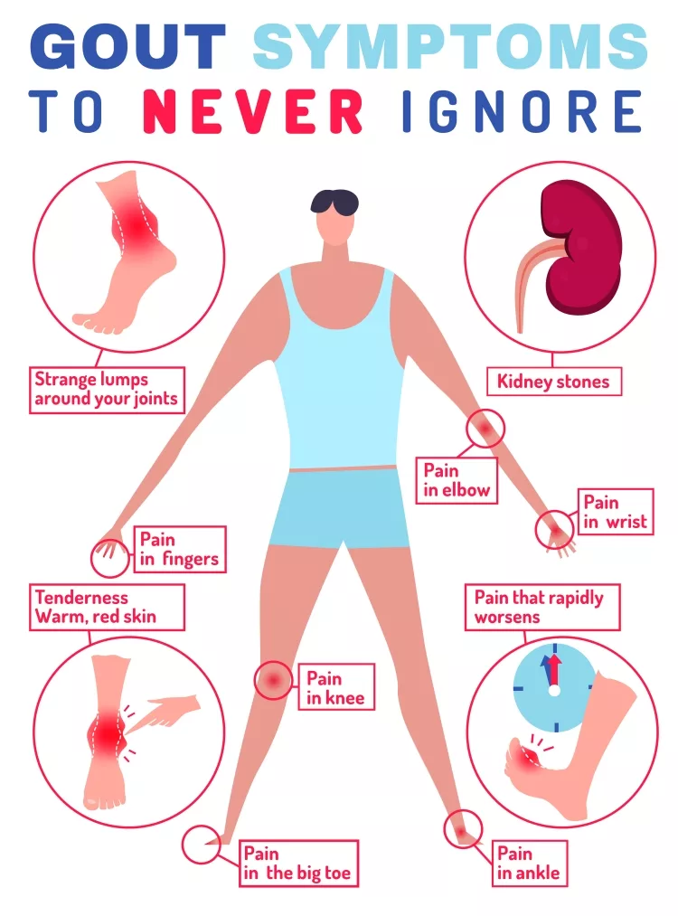 Gout Symptom Infographic