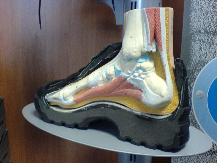 Curing Foot Arch Pain
