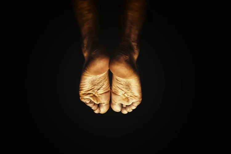Treating Foot Arch Pain Through Prevention