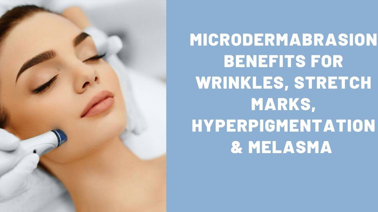 8 Microdermabrasion Benefits for wrinkles, stretch marks, hyperpigmentation &amp; melasma