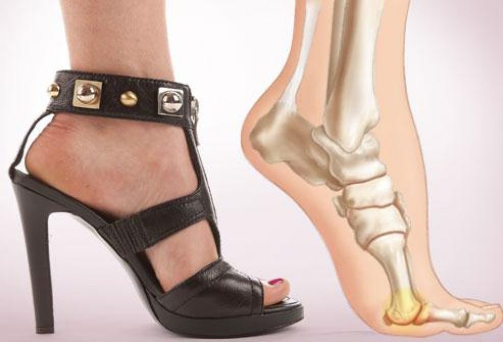 Best Walking Shoes For Lower Back Pain